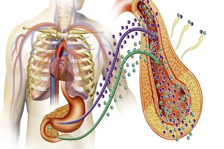 اختلال تولید انسولین در غدد درون ریز منجر به دیابت می شود