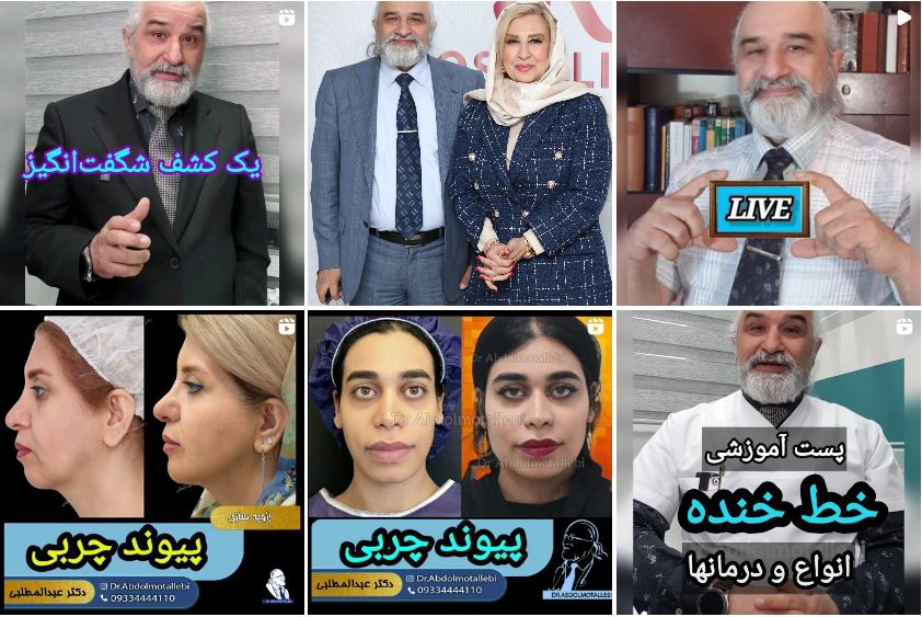 بهترین مرکز تزریق ژل در تهران