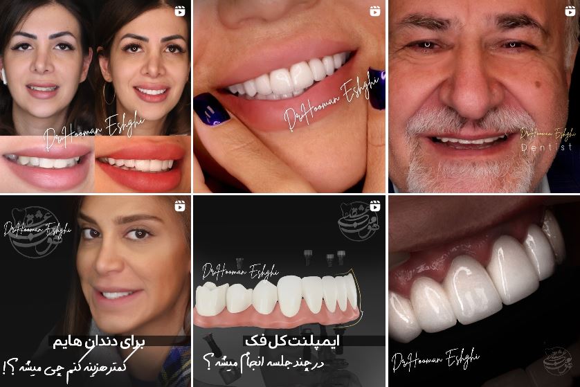 متخصص کامپوزیت دندان