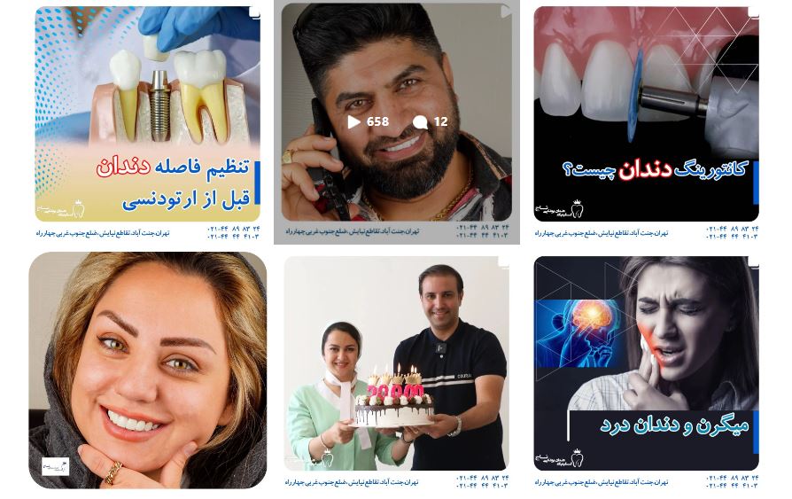 مرکز کامپوزیت دندان تاج