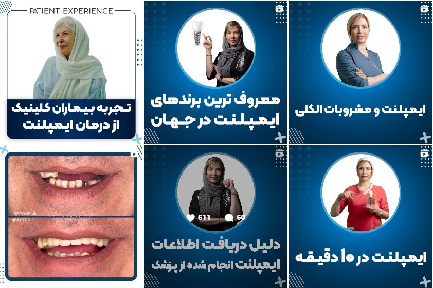 مرکز تخصصی ایمپلنت در تهران