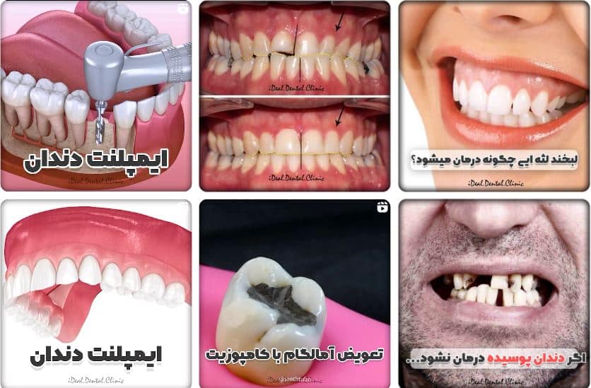 کلینیک دندانپزشکی ایده آل