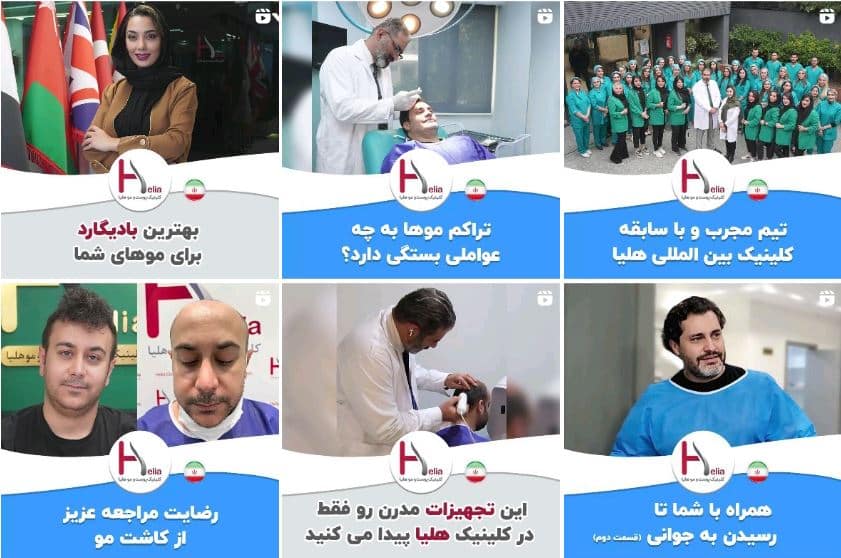 کلینیک کاشت مو هلیا